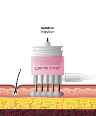 DermaShine Pro - THE ATHENAEUM OF ANTI-AGING